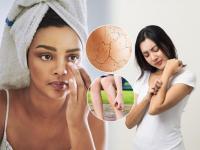 Winter Skincare: 6 Easy Tips to Keep Your Skin Moisturized and Healthy - News | Winter Skincare: 6 Easy Tips to Keep Your Skin Moisturized and Healthy | Latest lifestyle Photos at Lokmattimes.com