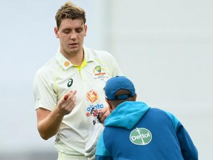 Cameron Green to undergo surgery for broken finger, IPL participation in doubt? | Cameron Green to undergo surgery for broken finger, IPL participation in doubt?