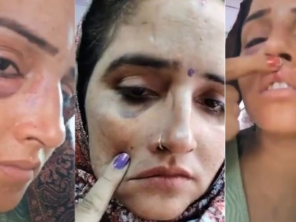 Seema Haider Beaten by Husband Sachin? Shocking Video of Pakistani Woman Showing Injury Marks Sparks Controversy | Seema Haider Beaten by Husband Sachin? Shocking Video of Pakistani Woman Showing Injury Marks Sparks Controversy