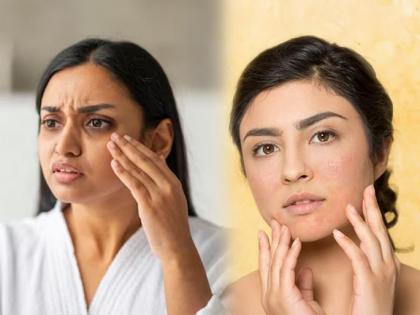 Are You Ignoring These 6 Signs on Your Face? They May Point to Serious Health Issues | Are You Ignoring These 6 Signs on Your Face? They May Point to Serious Health Issues Are You Ignoring These 6 Signs on Your Face? They May Point to Serious Health Issues | Are You Ignoring These 6 Signs on Your Face? They May Point to Serious Health Issues