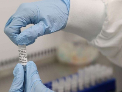 Russia planning to get COVID-19 vaccine in the market by mid August - Reports | Russia planning to get COVID-19 vaccine in the market by mid August - Reports