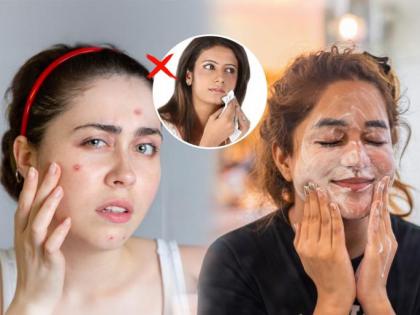 Beauty Tips: Avoid Acne This Monsoon With These Simple Yet Effective Skin Care Tips | Beauty Tips: Avoid Acne This Monsoon With These Simple Yet Effective Skin Care Tips Beauty Tips: Avoid Acne This Monsoon With These Simple Yet Effective Skin Care Tips | Beauty Tips: Avoid Acne This Monsoon With These Simple Yet Effective Skin Care Tips