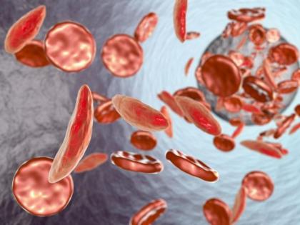 Anemia Symptoms: How to Recognize Low Hemoglobin Levels in Your Body