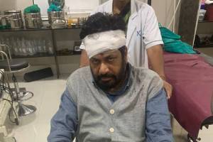 Maharashtra leader Bacchu Kadu injured in road accident | Maharashtra leader Bacchu Kadu injured in road accident Maharashtra leader Bacchu Kadu injured in road accident | Maharashtra leader Bacchu Kadu injured in road accident