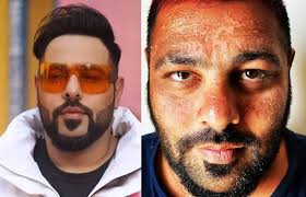 Rapper Badshah's Maldives holiday turns into a nightmare, skin gets burned and peeled off | Rapper Badshah's Maldives holiday turns into a nightmare, skin gets burned and peeled off