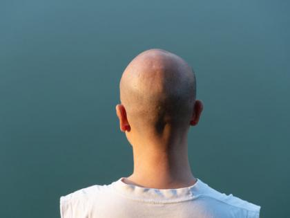 Spain Tops Global List of Bald Men With 44.50% of Population Affected, Check Complete List | Spain Tops Global List of Bald Men With 44.50% of Population Affected, Check Complete List