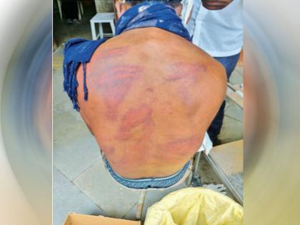 Beed Crime: Man Kidnapped and Beaten for Seven Hours, Suffers Serious Injuries | Beed Crime: Man Kidnapped and Beaten for Seven Hours, Suffers Serious Injuries