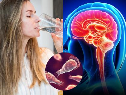 What Is Brain Eating Amoeba? Causes, Warning Signs, and How It’s Treated | What Is Brain Eating Amoeba? Causes, Warning Signs, and How It’s Treated