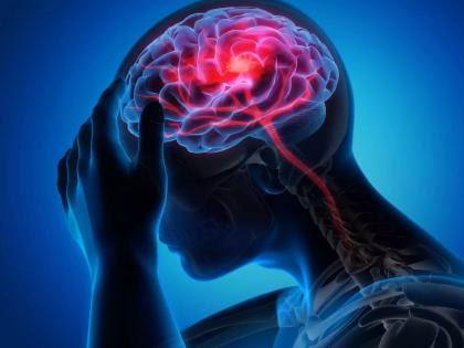 Climate Change Linked to Adverse Effects on Brain Health, Including Migraine and Alzheimer | Climate Change Linked to Adverse Effects on Brain Health, Including Migraine and Alzheimer