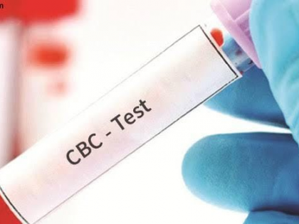 Complete Blood Count (CBC) Test: Purpose, Procedure, Normal Range, and Cost | Complete Blood Count (CBC) Test: Purpose, Procedure, Normal Range, and Cost