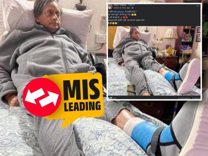 Fact Check: Viral Photo of Shashi Tharoor in Plaster Cast is From 2022, Not Recent | Fact Check: Viral Photo of Shashi Tharoor in Plaster Cast is From 2022, Not Recent Fact Check: Viral Photo of Shashi Tharoor in Plaster Cast is From 2022, Not Recent | Fact Check: Viral Photo of Shashi Tharoor in Plaster Cast is From 2022, Not Recent