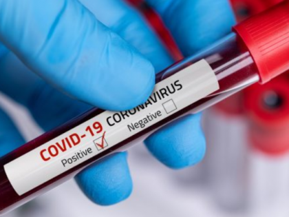 Pune reports 2,331 new coronavirus cases, 46 deaths | Pune reports 2,331 new coronavirus cases, 46 deaths