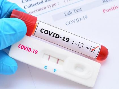COVID-19 Update: Mumbai Cases Drop Sharply; India’s Active Tally Drops By 428 | COVID-19 Update: Mumbai Cases Drop Sharply; India’s Active Tally Drops By 428 COVID-19 Update: Mumbai Cases Drop Sharply; India’s Active Tally Drops By 428 | COVID-19 Update: Mumbai Cases Drop Sharply; India’s Active Tally Drops By 428