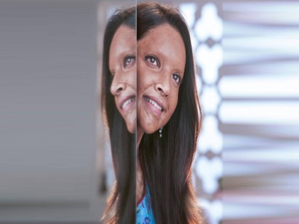 Deepika Padukone's 'Chhapaak' trailer will leave you tear-eyed | Deepika Padukone's 'Chhapaak' trailer will leave you tear-eyed