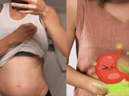 How To Reduce Bloating Problem Naturally? Know Home Remedies | How To Reduce Bloating Problem Naturally? Know Home Remedies