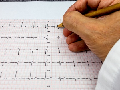 World Heart Day 2023: Get these routine check-ups to avoid sudden cardiac arrest | World Heart Day 2023: Get these routine check-ups to avoid sudden cardiac arrest