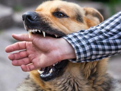 What to Do Immediately After a Dog Bite? Rabies Prevention Tips You Can’t Ignore | What to Do Immediately After a Dog Bite? Rabies Prevention Tips You Can’t Ignore What to Do Immediately After a Dog Bite? Rabies Prevention Tips You Can’t Ignore | What to Do Immediately After a Dog Bite? Rabies Prevention Tips You Can’t Ignore