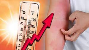 Skin ailments on rise by 30 percent in Mumbai due to scorching heat | Skin ailments on rise by 30 percent in Mumbai due to scorching heat