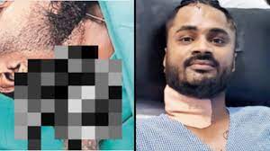 Navi Mumbai: Man rides to hospital with knife pierced into his neck after stabbed by brother | Navi Mumbai: Man rides to hospital with knife pierced into his neck after stabbed by brother Navi Mumbai: Man rides to hospital with knife pierced into his neck after stabbed by brother | Navi Mumbai: Man rides to hospital with knife pierced into his neck after stabbed by brother