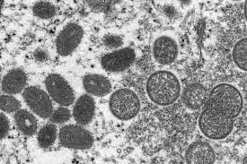 Tamil Nadu district collectors on alert across the state for Monkeypox | Tamil Nadu district collectors on alert across the state for Monkeypox Tamil Nadu district collectors on alert across the state for Monkeypox | Tamil Nadu district collectors on alert across the state for Monkeypox