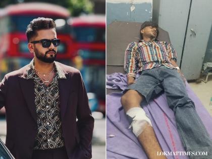 Elvish Yadav House Firing: Main Accused Shot in Leg, Arrested by Police | Elvish Yadav House Firing: Main Accused Shot in Leg, Arrested by Police