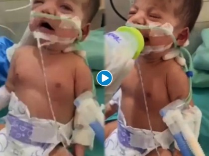 Watch Video! One month old girl recovers from covid after 10 days on ventilator, nothing short of a miracle, says doc | Watch Video! One month old girl recovers from covid after 10 days on ventilator, nothing short of a miracle, says doc