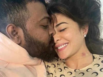 Jacqueline Fernandez and Sukesh Chandrasekhar’s new picture goes viral, actress flaunts her love bite | Jacqueline Fernandez and Sukesh Chandrasekhar’s new picture goes viral, actress flaunts her love bite