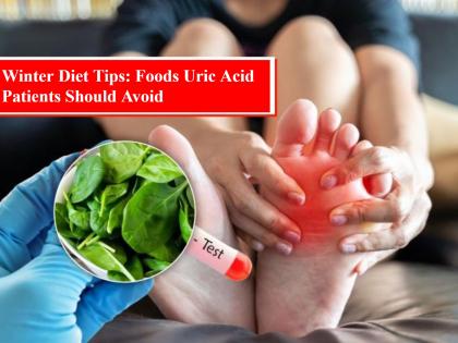 These 3 Common Winter Vegetables Can Worsen Uric Acid Problems — Know What to Avoid | These 3 Common Winter Vegetables Can Worsen Uric Acid Problems — Know What to Avoid