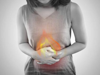 Home remedies To Get Rid from Stomach Burning and Gas | Home remedies To Get Rid from Stomach Burning and Gas Home remedies To Get Rid from Stomach Burning and Gas | Home remedies To Get Rid from Stomach Burning and Gas