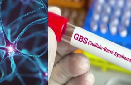 GBS Outbreak in Maharashtra: Five More Suspected Guillain-Barré Syndrome Cases Detected in Pune, Tally Rises to 197 | GBS Outbreak in Maharashtra: Five More Suspected Guillain-Barré Syndrome Cases Detected in Pune, Tally Rises to 197