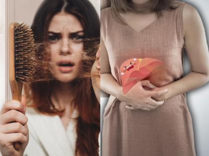 Suffering From Hair Fall? Poor Liver Health Might Be the Hidden Cause, Know How | Suffering From Hair Fall? Poor Liver Health Might Be the Hidden Cause, Know How Suffering From Hair Fall? Poor Liver Health Might Be the Hidden Cause, Know How | Suffering From Hair Fall? Poor Liver Health Might Be the Hidden Cause, Know How