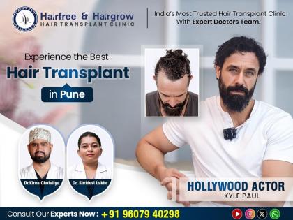 HairFree & HairGrow Leads as Pune’s #1 Choice for Hair Transplants with 100% Success Rate | HairFree & HairGrow Leads as Pune’s #1 Choice for Hair Transplants with 100% Success Rate HairFree & HairGrow Leads as Pune’s #1 Choice for Hair Transplants with 100% Success Rate | HairFree & HairGrow Leads as Pune’s #1 Choice for Hair Transplants with 100% Success Rate