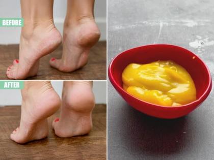 Beauty Tips: Home Remedies For Cracked and Dry Heels | Beauty Tips: Home Remedies For Cracked and Dry Heels Beauty Tips: Home Remedies For Cracked and Dry Heels | Beauty Tips: Home Remedies For Cracked and Dry Heels