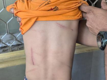 Mumbai: Bhandup Couple Arrested for Torturing Domestic Help’s 2.5-Year-Old Child Over ‘Evil Spirit’ Suspicion | Mumbai: Bhandup Couple Arrested for Torturing Domestic Help’s 2.5-Year-Old Child Over ‘Evil Spirit’ Suspicion Mumbai: Bhandup Couple Arrested for Torturing Domestic Help’s 2.5-Year-Old Child Over ‘Evil Spirit’ Suspicion | Mumbai: Bhandup Couple Arrested for Torturing Domestic Help’s 2.5-Year-Old Child Over ‘Evil Spirit’ Suspicion