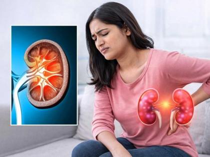 Did You Know? Excessive Gym Workouts, Supplements, and Painkillers Are Silent Causes of Kidney Damage | Did You Know? Excessive Gym Workouts, Supplements, and Painkillers Are Silent Causes of Kidney Damage Did You Know? Excessive Gym Workouts, Supplements, and Painkillers Are Silent Causes of Kidney Damage | Did You Know? Excessive Gym Workouts, Supplements, and Painkillers Are Silent Causes of Kidney Damage