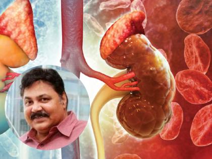 Satish Shah Dies of Kidney Failure; Know the Causes and Symptoms You Should Never Ignore | Satish Shah Dies of Kidney Failure; Know the Causes and Symptoms You Should Never Ignore Satish Shah Dies of Kidney Failure; Know the Causes and Symptoms You Should Never Ignore | Satish Shah Dies of Kidney Failure; Know the Causes and Symptoms You Should Never Ignore