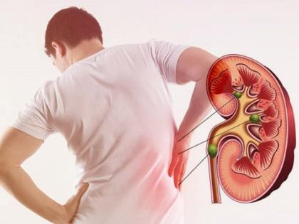 Why Spinach and Tomatoes Together May Be Harmful for Kidney Stone Patients | Why Spinach and Tomatoes Together May Be Harmful for Kidney Stone Patients