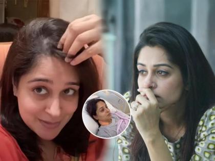 Dipika Kakar Opens Up on Stage 2 Liver Cancer Treatment, Says Hair Loss Has Left Her Upset | Dipika Kakar Opens Up on Stage 2 Liver Cancer Treatment, Says Hair Loss Has Left Her Upset