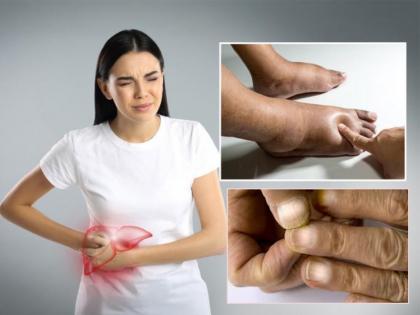 Early Signs of Liver Problems You Should Never Ignore | Early Signs of Liver Problems You Should Never Ignore Early Signs of Liver Problems You Should Never Ignore | Early Signs of Liver Problems You Should Never Ignore