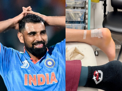 Mohammed Shami Gives Major Update on His Recovery After Heel Surgery | Mohammed Shami Gives Major Update on His Recovery After Heel Surgery