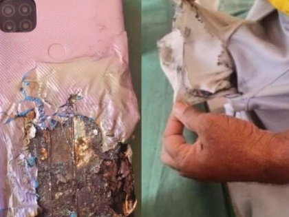 Telangana: Mobile Phone Explodes in Man's Pants Pocket in Kamareddy, No Injuries Reported | Telangana: Mobile Phone Explodes in Man's Pants Pocket in Kamareddy, No Injuries Reported Telangana: Mobile Phone Explodes in Man's Pants Pocket in Kamareddy, No Injuries Reported | Telangana: Mobile Phone Explodes in Man's Pants Pocket in Kamareddy, No Injuries Reported