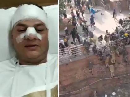 Watch Video! Tractor rally violence: Injured cop narrates attack by farmers at Red Fort | Watch Video! Tractor rally violence: Injured cop narrates attack by farmers at Red Fort Watch Video! Tractor rally violence: Injured cop narrates attack by farmers at Red Fort | Watch Video! Tractor rally violence: Injured cop narrates attack by farmers at Red Fort