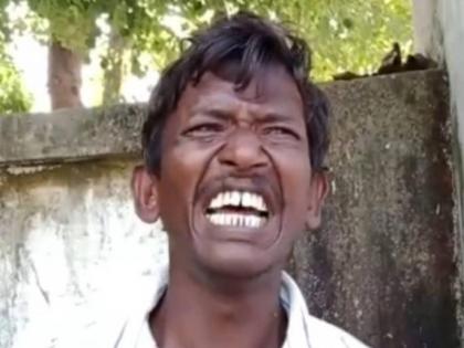 UP: Man reaches police station after wife bites, beats him | UP: Man reaches police station after wife bites, beats him UP: Man reaches police station after wife bites, beats him | UP: Man reaches police station after wife bites, beats him