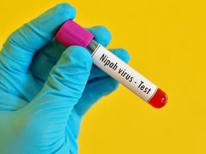 Nipah Virus in Kerala: Contact List Risk Expanded to 406; 194 in High-Risk Category, Says Health Minister | Nipah Virus in Kerala: Contact List Risk Expanded to 406; 194 in High-Risk Category, Says Health Minister Nipah Virus in Kerala: Contact List Risk Expanded to 406; 194 in High-Risk Category, Says Health Minister | Nipah Virus in Kerala: Contact List Risk Expanded to 406; 194 in High-Risk Category, Says Health Minister