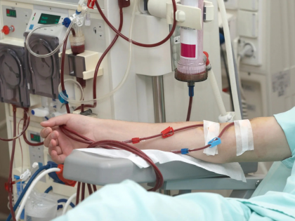 Why Dialysis Is Done Before Kidney Transplant in Some Patients | Why Dialysis Is Done Before Kidney Transplant in Some Patients Why Dialysis Is Done Before Kidney Transplant in Some Patients | Why Dialysis Is Done Before Kidney Transplant in Some Patients