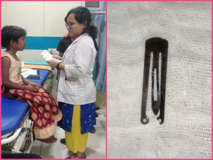 Doctors remove hair clip stuck from 6-year-old girl's stomach | Doctors remove hair clip stuck from 6-year-old girl's stomach