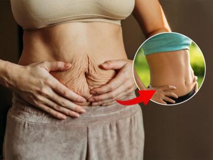 How to Reduce Belly Fat After Delivery: Gynecologist Shares 5 Safe Remedies for New Moms | How to Reduce Belly Fat After Delivery: Gynecologist Shares 5 Safe Remedies for New Moms How to Reduce Belly Fat After Delivery: Gynecologist Shares 5 Safe Remedies for New Moms | How to Reduce Belly Fat After Delivery: Gynecologist Shares 5 Safe Remedies for New Moms