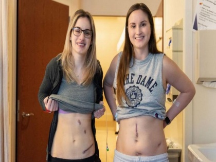 Sister's from America donate kidney to strangers for transplant surgery | Sister's from America donate kidney to strangers for transplant surgery