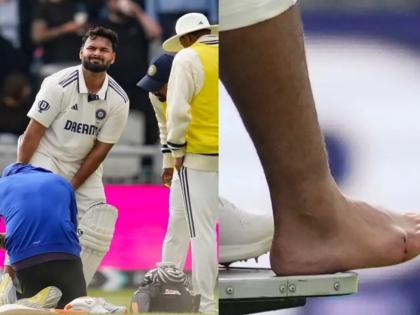 Rishabh Pant Ruled Out of Ongoing 4th Test with Fractured Toe; Ishan Kishan Likely for 5th Match: Sources | Rishabh Pant Ruled Out of Ongoing 4th Test with Fractured Toe; Ishan Kishan Likely for 5th Match: Sources