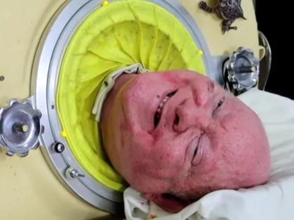 Paul Alexander Dies After Living in 7ft Iron Lung for More Than 70 Years | Paul Alexander Dies After Living in 7ft Iron Lung for More Than 70 Years Paul Alexander Dies After Living in 7ft Iron Lung for More Than 70 Years | Paul Alexander Dies After Living in 7ft Iron Lung for More Than 70 Years